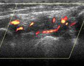 ecografia-musculoesqueletica imagen de artículo