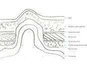 eventracion-causas-sintomas-y-tratamiento imagen de artículo