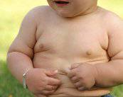 el-obeso-morbido-con-menor-esperanza-de-vida-que-una-persona-con-vih imagen de artículo