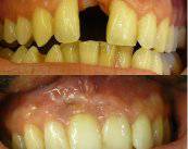 conoce-mas-a-cerca-de-los-traumatismos-dentales imagen de artículo