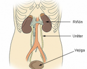 todo-lo-que-has-de-saber-del-cancer-de-vejiga imagen de artículo