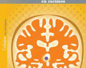 tratamiento-de-la-cefalea-en-racimos imagen de artículo