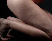 el-uso-de-la-carboxiterapia-para-combatir-la-celulitis imagen de artículo