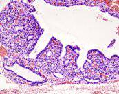 hormonas-tiroideas-ni-altas-ni-bajas imagen de artículo