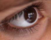 Nistagmus: un movimiento de los ojos