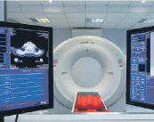 La Radioterapia Estereotáxica de cuerpo revoluciona el Cáncer de Pulmón