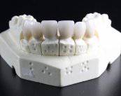 Elimina tu miedo al dentista: Prótesis Dentales novedosas y seguras