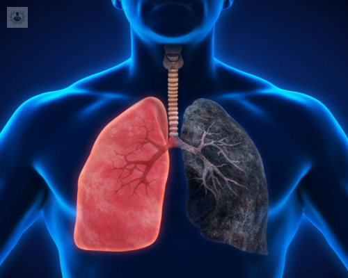 Tabaco: causa principal del Enfisema Pulmonar