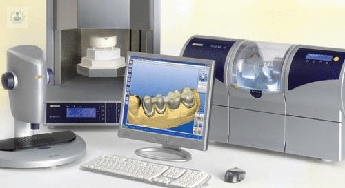 CAD-CAM, técnica para diseñar sonrisas