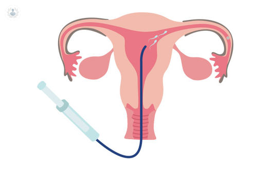 la-inseminacion-artificial-la-tecnica-de-reproduccion-asistida-mas-antigua imagen de artículo