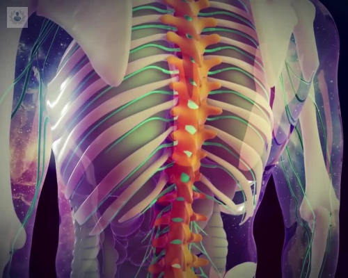 ¿Cómo se debe tratar la Estenosis Lumbar?