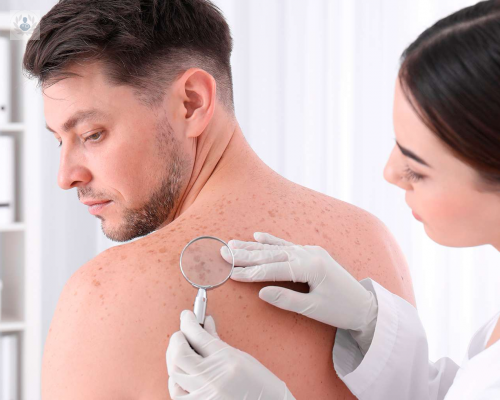 queratosis-actinica-una-patologia-en-aumento imagen de artículo