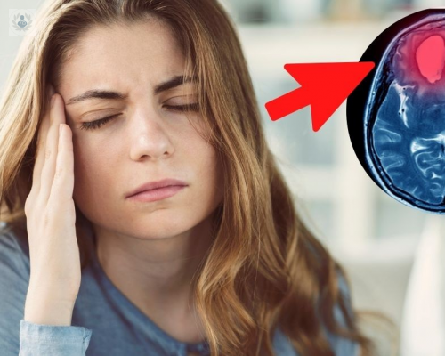 que-factores-de-riesgo-provocan-un-aneurisma imagen de artículo