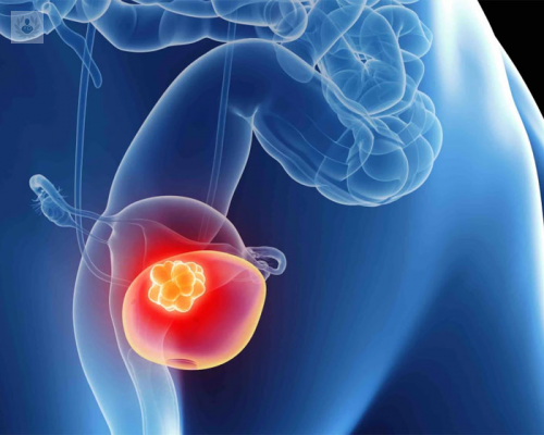 ¿Cómo tratar los diferentes Tumores Urológicos?