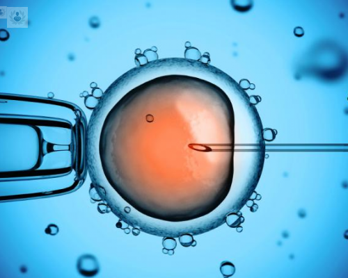 la-fecundacion-in-vitro-una-tecnica-efectiva-para-conseguir-un-embarazo imagen de artículo