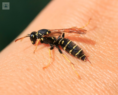 picadura-de-avispa-y-de-abeja imagen de artículo