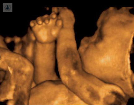 cuando-se-debe-hacer-la-ecografia-4d imagen de artículo