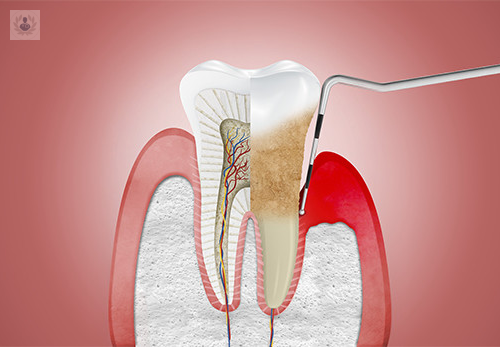 El envejecimiento es inevitable, la pérdida de dientes no