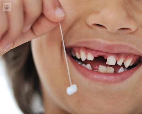 por-que-se-caen-los-dientes-de-leche imagen de artículo