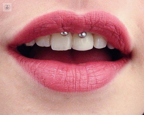 Piercings orales, una moda con riesgo para la salud bucodental