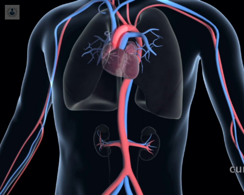que-hay-que-saber-sobre-el-aneurisma-de-aorta imagen de artículo