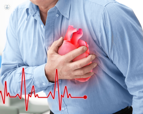 Factores de riesgo en Enfermedades Cardiovasculares