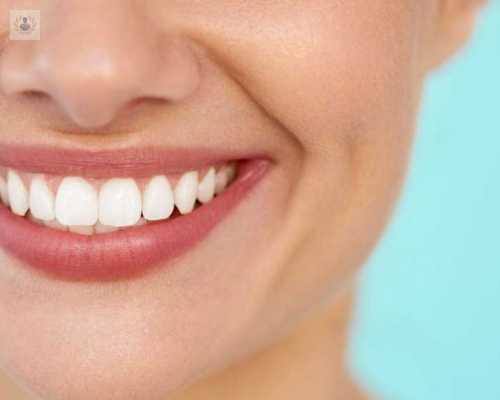 Estética dental, creadora de sonrisas perfectas
