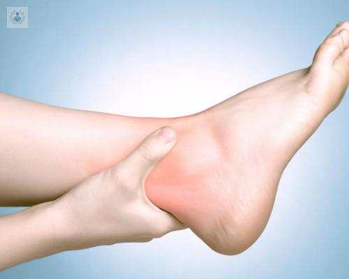 por-que-nos-hacemos-tantos-esguinces-de-tobillo imagen de artículo