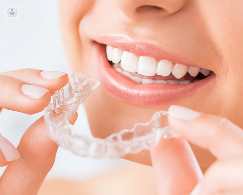 ortodoncia-invisible-una-alternativa-a-los-brackets-convencionales imagen de artículo