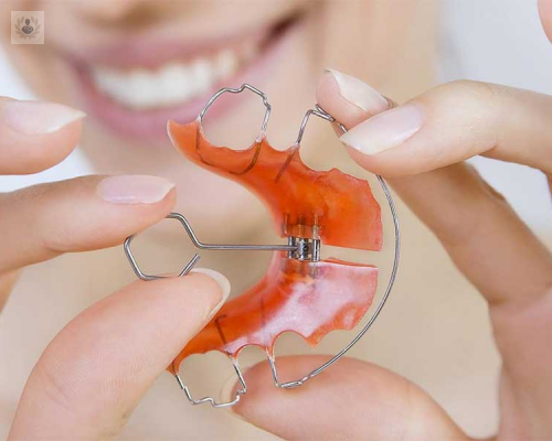 Retenedores Dentales, imprescindibles tras una Ortodoncia Invisible