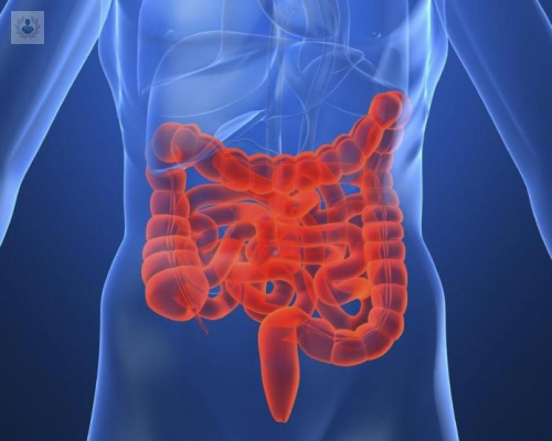 causas-sintomas-diagnostico-y-tratamiento-de-la-enfermedad-de-crohn imagen de artículo