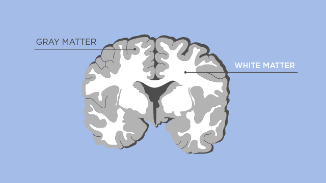 La sustancia blanca del deals cerebro